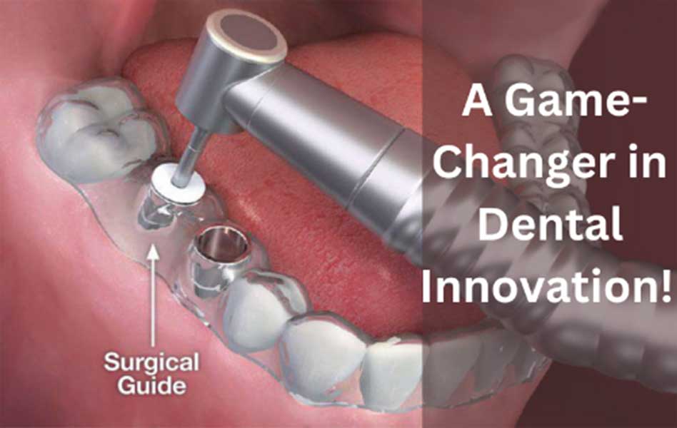 Guided implant surgery