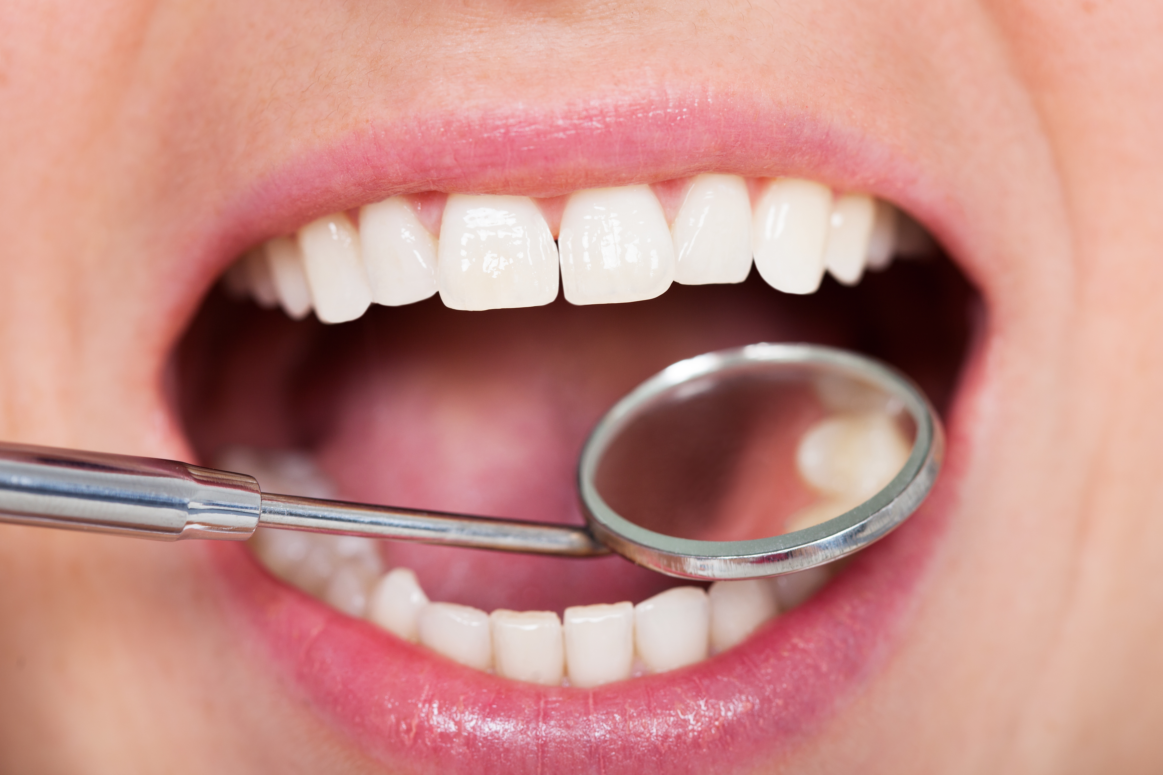 Dental check-up